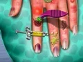 Permainan Dokter Kulit Tangan secara online